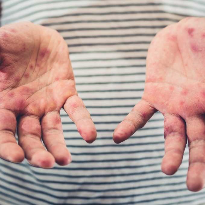 Infectious Disease Cleanup In Utah	Near Me